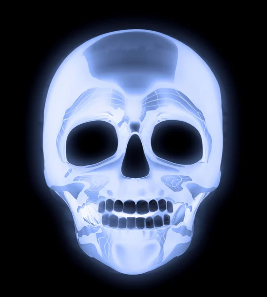 RTG czaszki człowieka — Zdjęcie stockowe