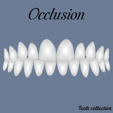 occlusion clenched teeth clipart