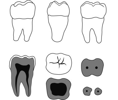 farklı açıları ile molar diş