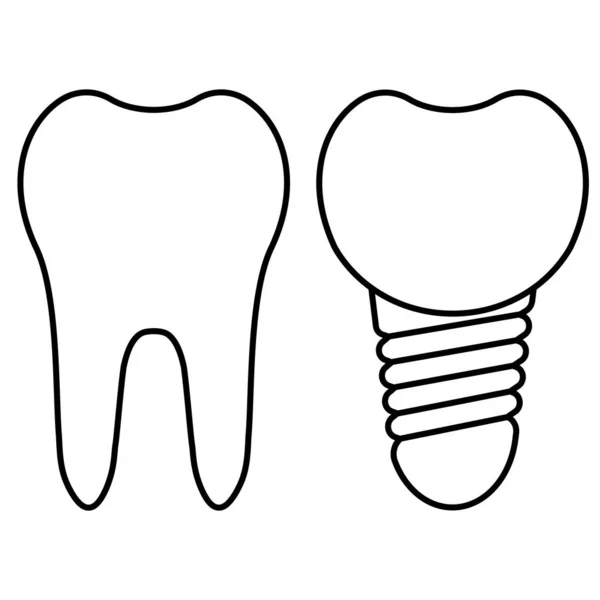 Cirurgia dentária. Implante cortado e dente saudável. Coroa de implante dentário vetorial realista. Elementos de estomatologia —  Vetores de Stock