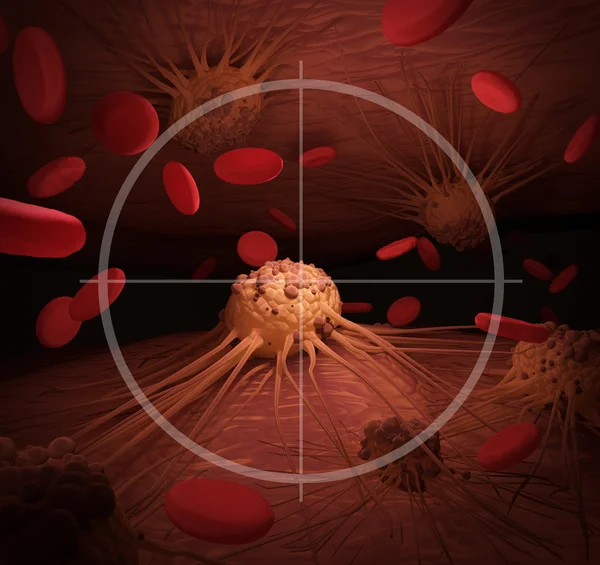 Targeting Cancer With Treatment — Stock Photo, Image