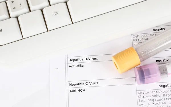 Laboratory test, Hepatitis C, blood tubes on note, keyboard — Stock Photo, Image