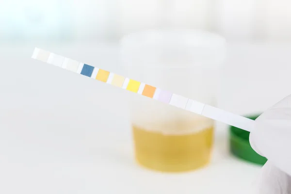 Medicinska urinprov med urin teststickor, närbild — Stockfoto
