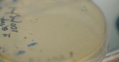 Macro shot of developed bacteria growing in a Petri dish during an examination in a professional medical laboratory.