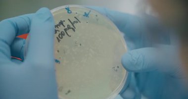 Scientist in medical lab examining bacteria with Petri dish. Inspecting and analyzing samples.