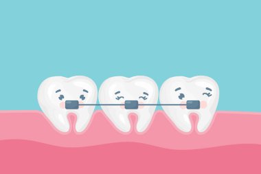 Diş teli vektör afiş şablonu. Metal telli şirin mutlu dişler. Ortodontik tedavi, ısırık düzeltme ya da çene hizalama konsepti. Vektör illüstrasyonu