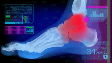 Analiz - grafik - mavi ayak