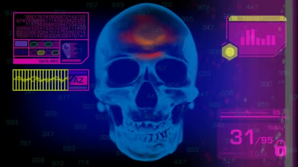 Skull Analysis - Graphics - Pink — Stock Video