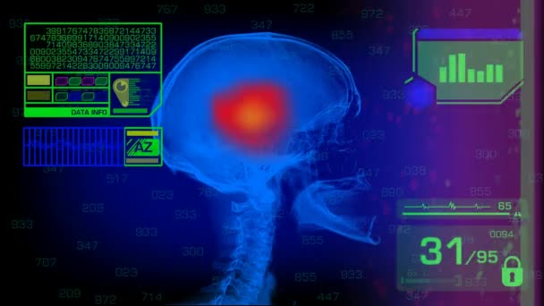Analyse du crâne - Graphiques - Vert 
