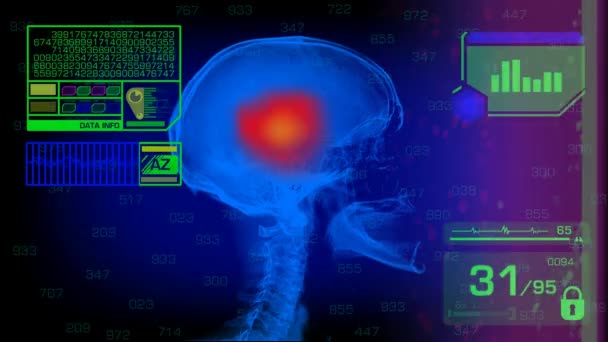 Análise de crânio - Gráficos - Verde — Vídeo de Stock