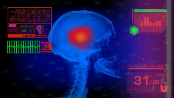 Schädelanalyse - Grafik - rot — Stockvideo