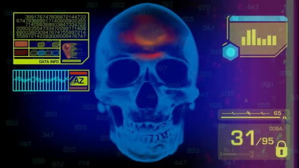 Skull Analysis - Graphics - Yellow — Stock Video