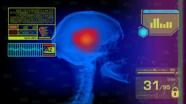 Skull Analysis - Graphics - Yellow — Stock Video