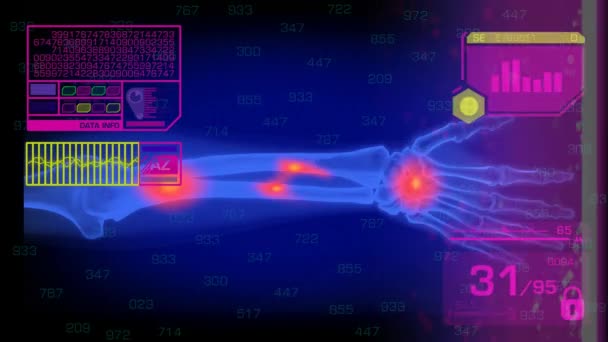 Analyse des bras - Graphiques - Rose 