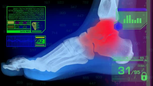 Voet analyse - Graphics - groen — Stockvideo