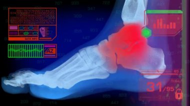 Ayak analizi - grafik - kırmızı