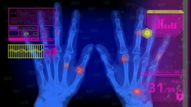 Analiz - grafik - pembe eller