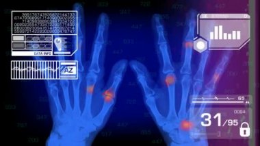 Analiz - grafik - beyaz eller