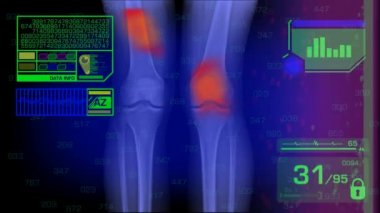 Bacaklar analiz - grafik - yeşil