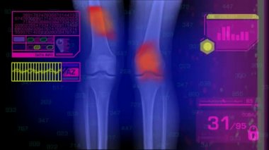 Bacaklar analiz - grafik - pembe 01