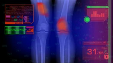 Bacaklar analiz - grafik - kırmızı 01