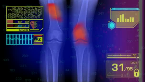 Legs Analysis - Graphics - Yellow — Stock Video