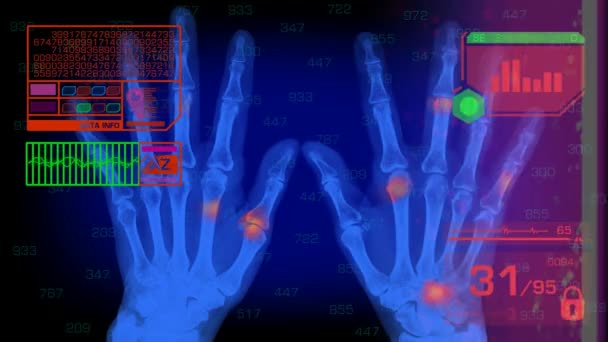 Analisi delle mani - Grafica - Rosso — Video Stock