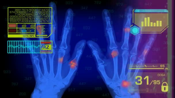 Análise das mãos - Gráficos - Amarelo — Vídeo de Stock