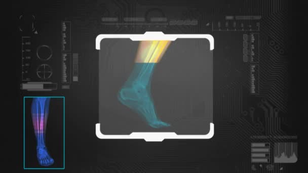 Nožní naskenovaný - Digital Interface - černá — Stock video