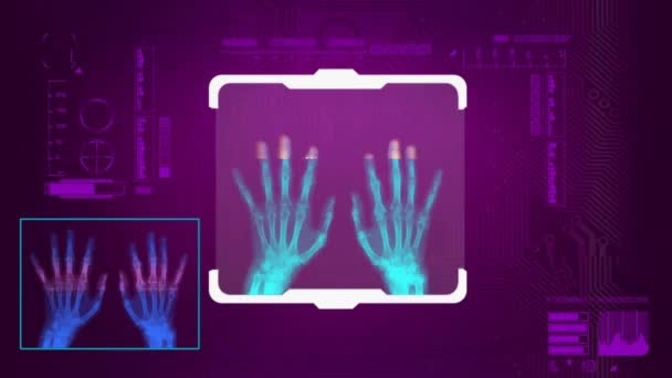 Отсканированные руки - цифровой интерфейс - розовый — стоковое видео
