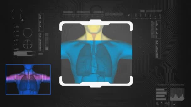 Lungs Scanned - Digital Interface - black — Stock Video
