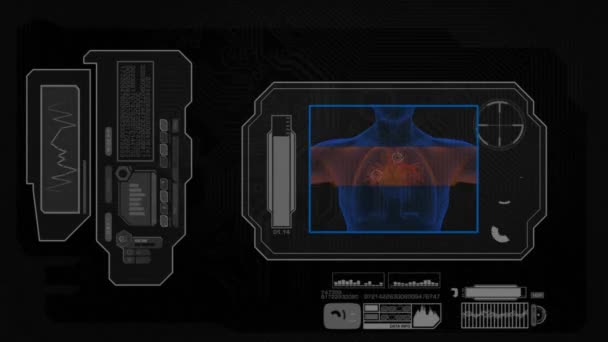 Analyse numérique - Coeur - noir 