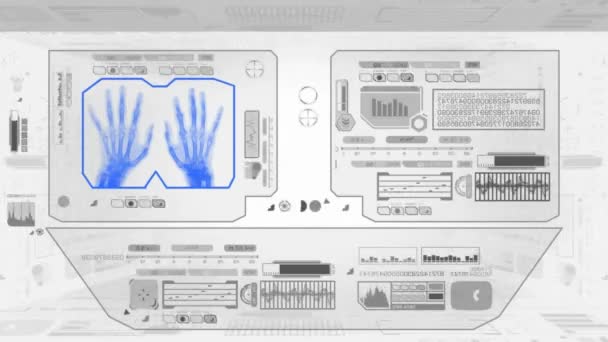 Controllo medico delle mani - bianco — Video Stock