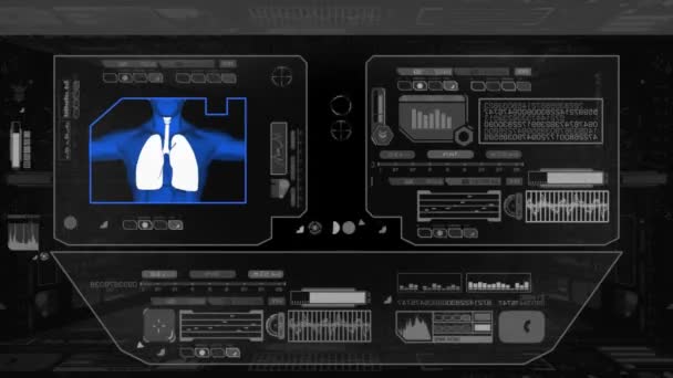 Легенів медичні перевірка - чорний — стокове відео
