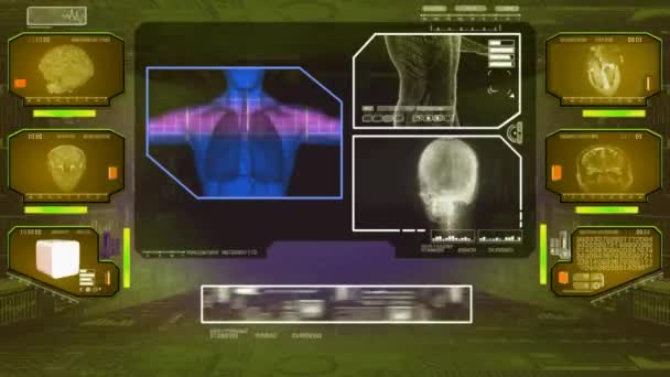 Análisis de pulmones - Escaneo de alta tecnología - Amarillo 01 — Vídeos de Stock