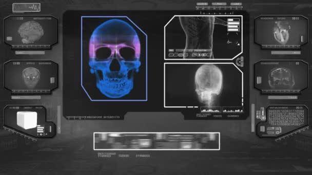 Skull Analysis - High Tech Scan - Black 01 — Stock Video