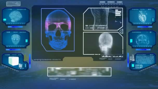 Analyse du crâne - High Tech Scan - Bleu 01 
