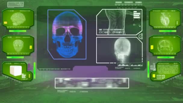 Analyse du crâne - High Tech Scan - Vert 01 