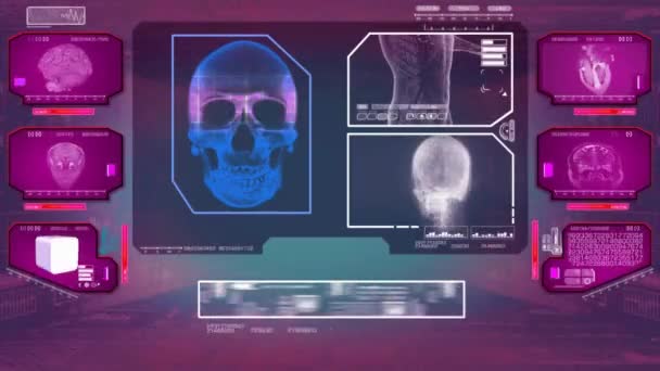 Análisis de cráneo - Escaneo de alta tecnología - Rosa 01 — Vídeos de Stock