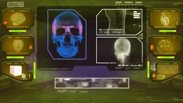 Analyse du crâne - High Tech Scan - Jaune 01 