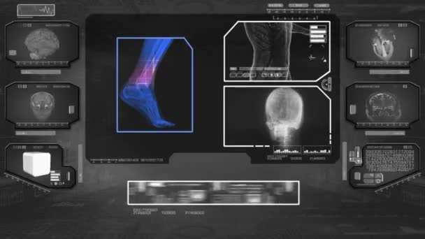 Analyse des pieds - High Tech Scan - Noir 01 — Video