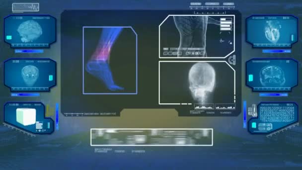 Fot analys - High Tech Scan - blå 01 — Stockvideo