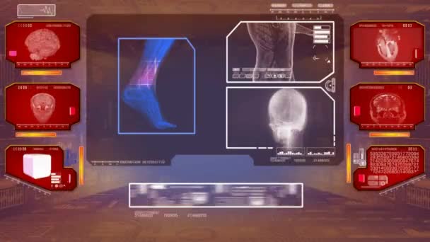 Analyse des pieds - High Tech Scan - Rouge 01 — Video