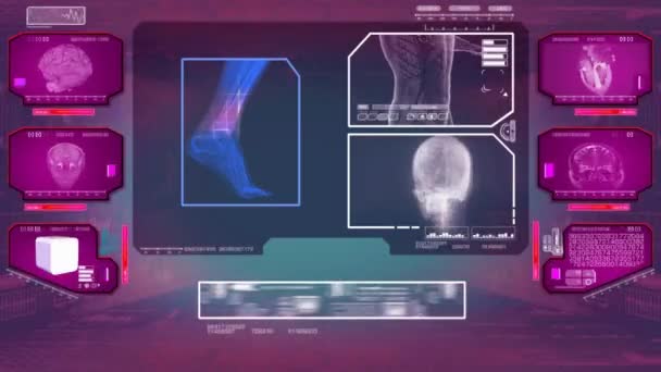 脚分析-高科技扫描-粉红色 01 — 图库视频影像