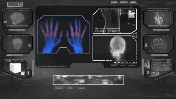 Händerna analys - High Tech Scan - svart 01 — Stockvideo