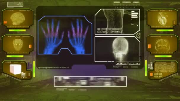 Handen analyse - High Tech Scan - gele 01 — Stockvideo