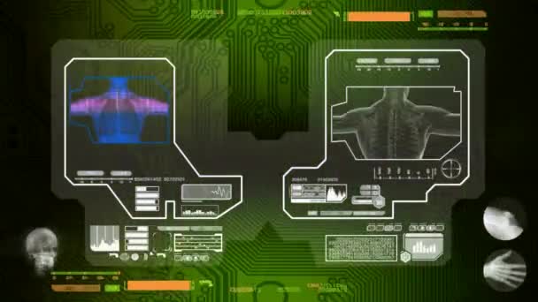 Lungs - Scanned by Software - green — Stock Video