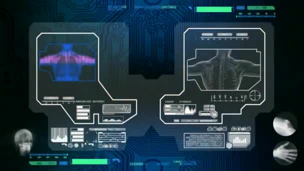 Pulmones - Escaneado por software - azul — Vídeos de Stock