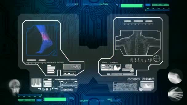 Pé - Scaned por Software - azul — Vídeo de Stock