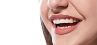 Beyaz arka planda diş telleri olan kadın ağzı.